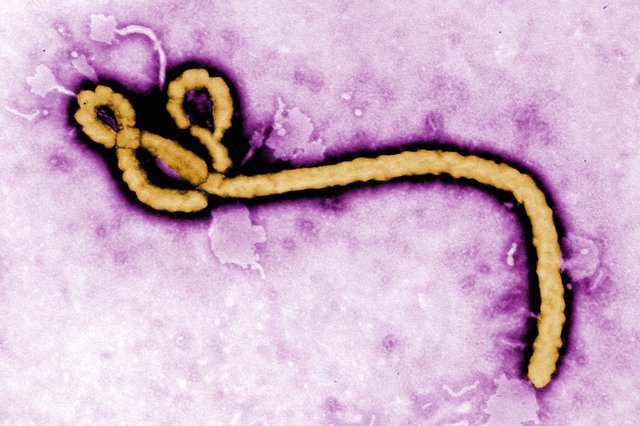 ebola-050814
