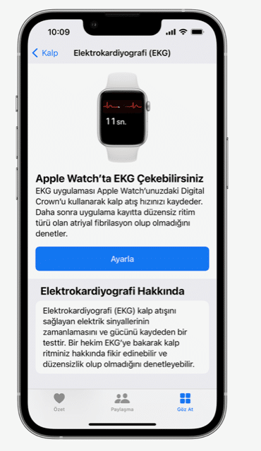 apple watch ekg