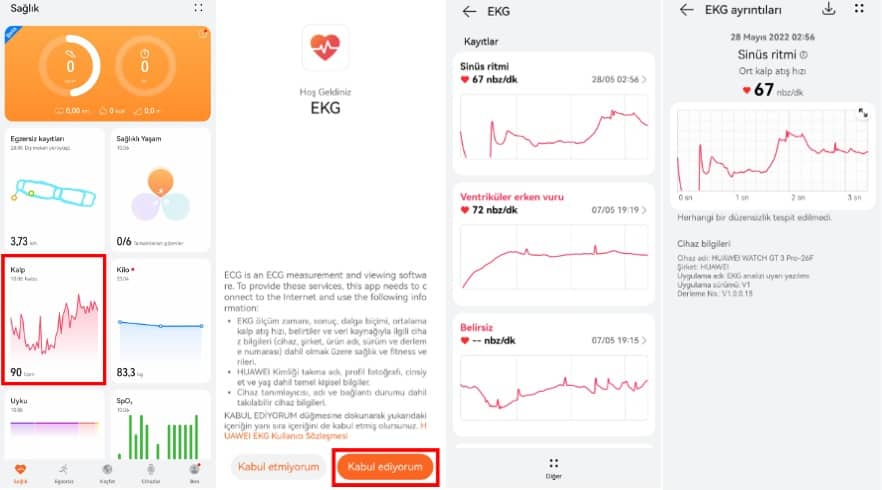 huawei watch gt 3 pro ekg